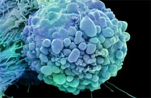 cancer-cell