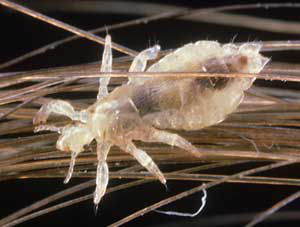 photolibrary_rm_photo_of_louse_on_human_hair
