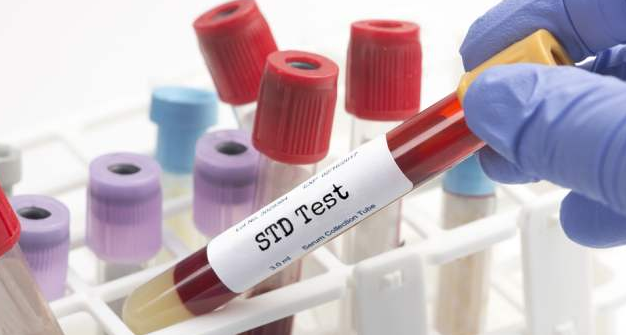 STD